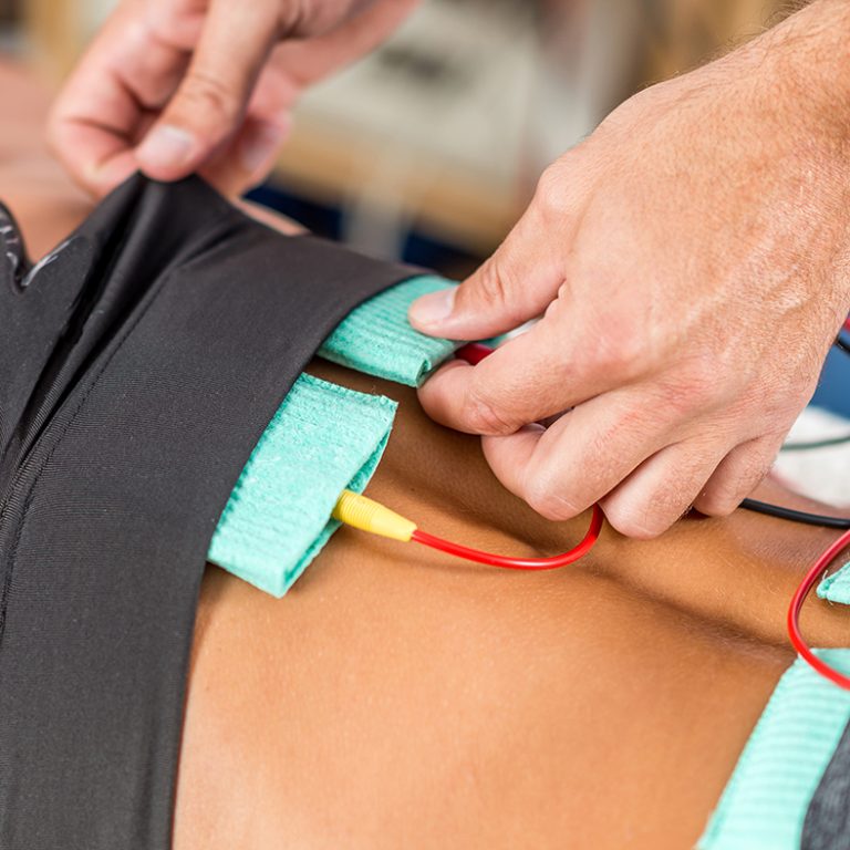 Electrical stimulation in physical therapy. Therapist positioning electrodes onto a female athlete's lower back muscles